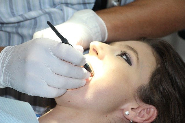 zubní kontrola